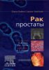 Рак простаты