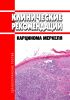 Клинические рекомендации "Карцинома Меркеля" (Взрослые)