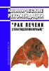 Клинические рекомендации "Рак печени (гепатоцеллюлярный)" (Взрослые) 2025 год. Последняя редакция