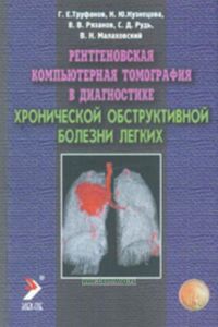 Рентгеновская компьютерная томография в диагностике хронической обструктивной болезни легких
