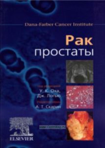 Рак простаты