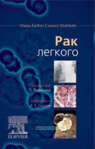 Рак легкого