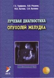 Лучевая диагностика опухолей желудка