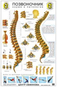 Плакат Позвоночник. Норма и патология