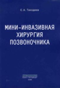Мини-инвазивная хирургия позвоночника