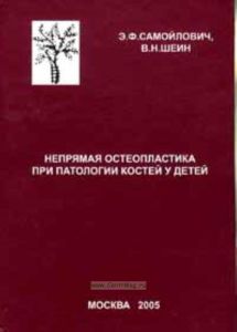Непрямая остеопластика при патологии костей у детей