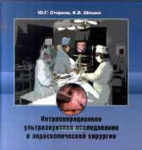 Интраоперационное ультразвуковое исследование в эндоскопической хирургии