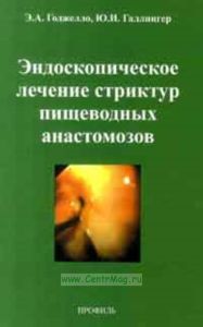 Эндоскопическое лечение стриктур пищеводных анастомозов