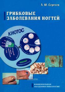 Грибковые заболевания ногтей