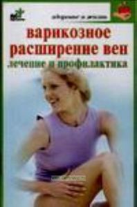 Варикозное расширение вен: Лечение и профилактика