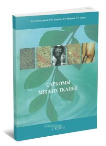 Саркомы мягких тканей: практическое руководство для врачей