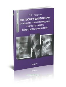 Рентгенологические критерии затихания и полной ликвидации костно-суставного туберкулезного воспаления