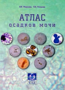Атлас осадков мочи