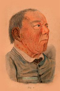 Карманный медицинский атлас болезней кожи. Том III