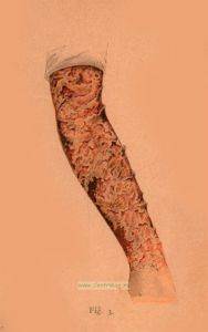 Карманный медицинский атлас болезней кожи. Том III