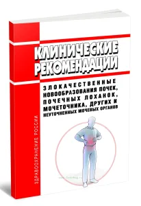 Клинические рекомендации Злокачественные новообразования почек, почечных лоханок, мочеточника, других и неуточненных мочевых органов (Дети)