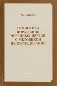 Семиотика поражения черепных нервов с методикой их обследования