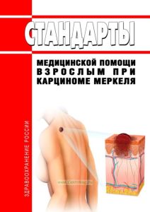 Стандарты медицинской помощи взрослым при карциноме Меркеля 2025 год. Последняя редакция