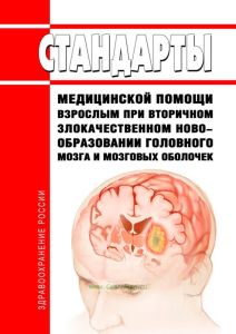Стандарты медицинской помощи взрослым при вторичном злокачественном новообразовании головного мозга и мозговых оболочек 2025 год. Последняя редакция