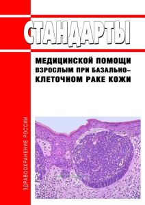 Стандарты медицинской помощи взрослым при базальноклеточном раке кожи 2025 год. Последняя редакция