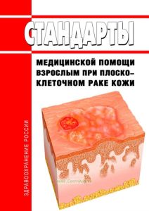 Стандарты медицинской помощи взрослым при плоскоклеточном раке кожи 2025 год. Последняя редакция