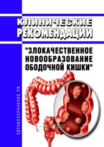 Клинические рекомендации "Злокачественное новообразование ободочной кишки" (Взрослые) 2025 год. Последняя редакция