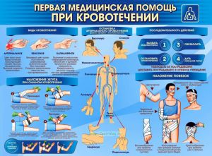 Плакат Первая медицинская помощь при кровотечении