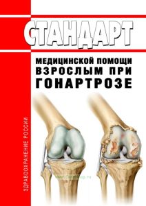 Стандарт медицинской помощи взрослым при гонартрозе 2025 год. Последняя редакция