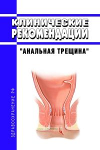 Клинические рекомендации "Анальная трещина" (Взрослые)