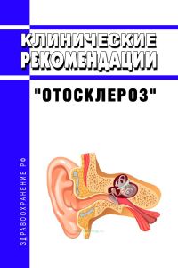 Клинические рекомендации "Отосклероз" (Взрослые, Дети)