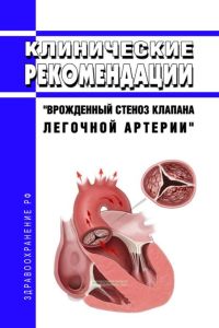 Клинические рекомендации "Врожденный стеноз клапана легочной артерии" (Дети)