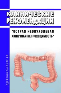 Клинические рекомендации "Острая неопухолевая кишечная непроходимость" (Взрослые)