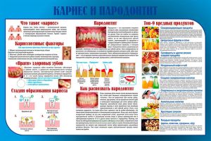 Плакат Кариес и пародонтит