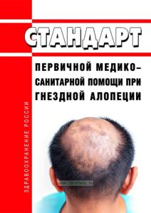 Стандарт первичной медико-санитарной помощи при гнездной алопеции