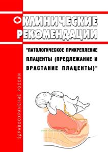 Клинические рекомендации "Патологическое прикрепление плаценты (предлежание и врастание плаценты)" 2025 год. Последняя редакция